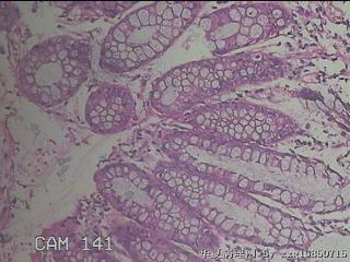乙状结肠粘膜图17