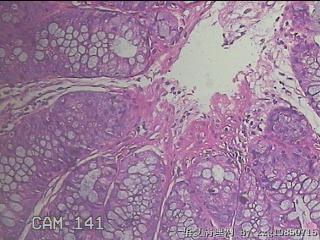 乙状结肠粘膜图37