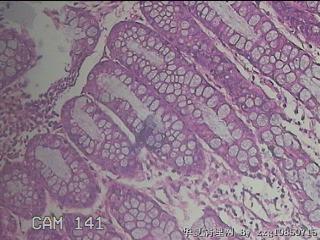 乙状结肠粘膜图18