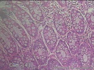 乙状结肠粘膜图34