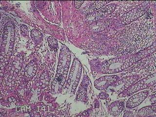 乙状结肠粘膜图8