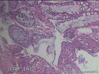 乙状结肠粘膜图42