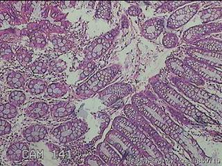 乙状结肠粘膜图7