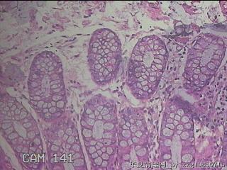 乙状结肠粘膜图31