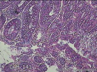 乙状结肠粘膜图15
