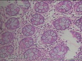 乙状结肠粘膜图28