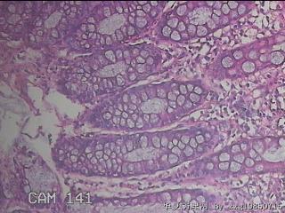 乙状结肠粘膜图41