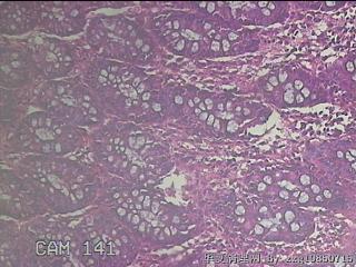 乙状结肠粘膜图1