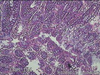 乙状结肠粘膜图14