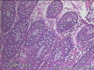 乙状结肠粘膜图49