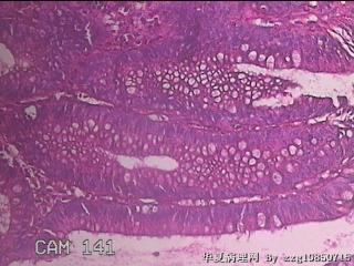 乙状结肠粘膜图20