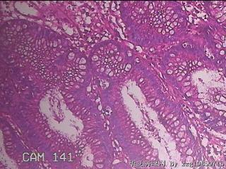 乙状结肠粘膜图25