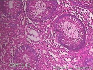 乙状结肠粘膜图47