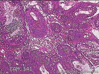 乙状结肠粘膜图8