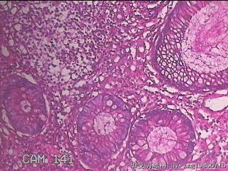 乙状结肠粘膜图49