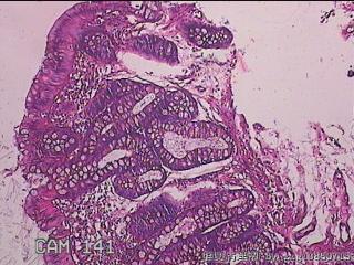 直肠粘膜图12