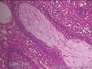 乙状结肠粘膜图40