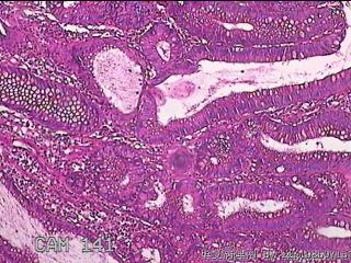 乙状结肠粘膜图6