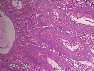 乙状结肠粘膜图22