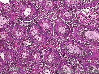 乙状结肠粘膜图10