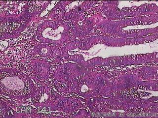 乙状结肠粘膜图5