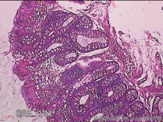 直肠粘膜图11