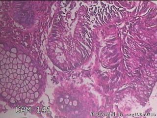 乙状结肠粘膜图16
