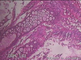 乙状结肠粘膜图17