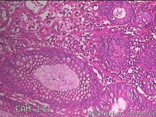 乙状结肠粘膜图38