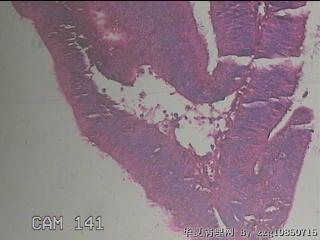 直肠粘膜图19