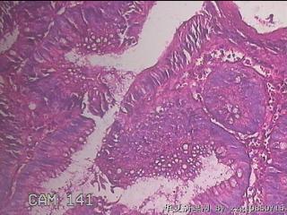 乙状结肠粘膜图32