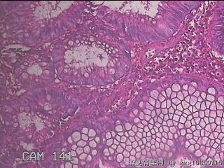 乙状结肠粘膜图31