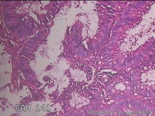 乙状结肠粘膜图34