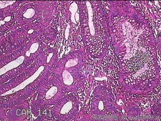 乙状结肠粘膜图9