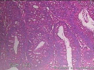 乙状结肠粘膜图43