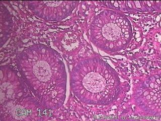 乙状结肠粘膜图48