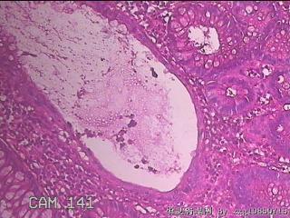 乙状结肠粘膜图27