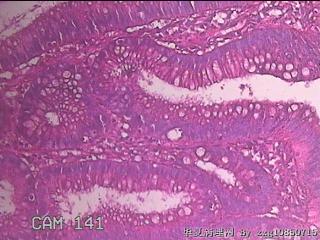乙状结肠粘膜图21