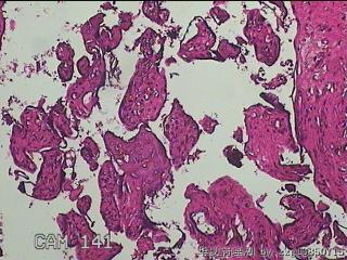 胎盘组织图21