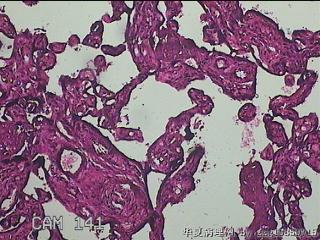 胎盘组织图14