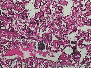 胎盘组织图29