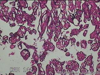 胎盘组织图19