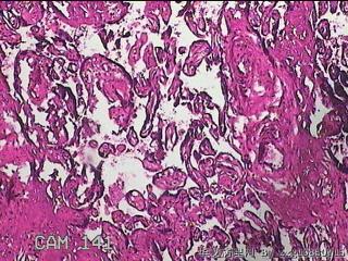 胎盘组织图39