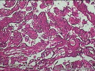 胎盘组织图33