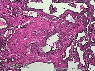 胎盘组织图15