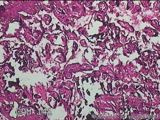 胎盘组织图34
