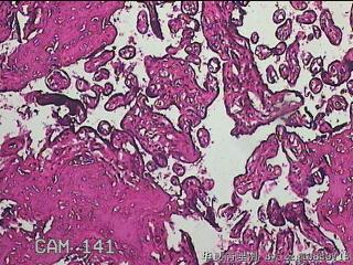 胎盘组织图37