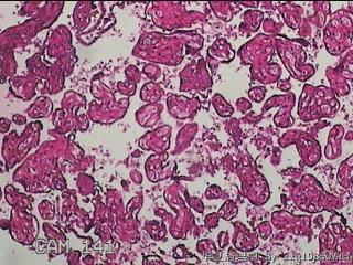 胎盘组织图31