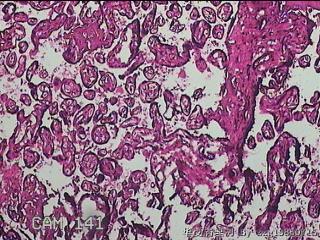 胎盘组织图38