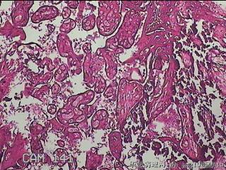 胎盘组织图32
